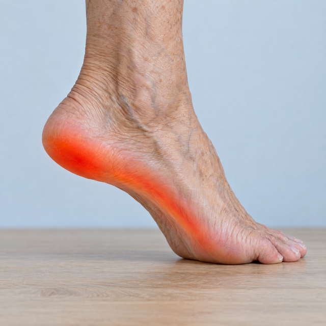 Heel and arch with the painful area highlighted in red